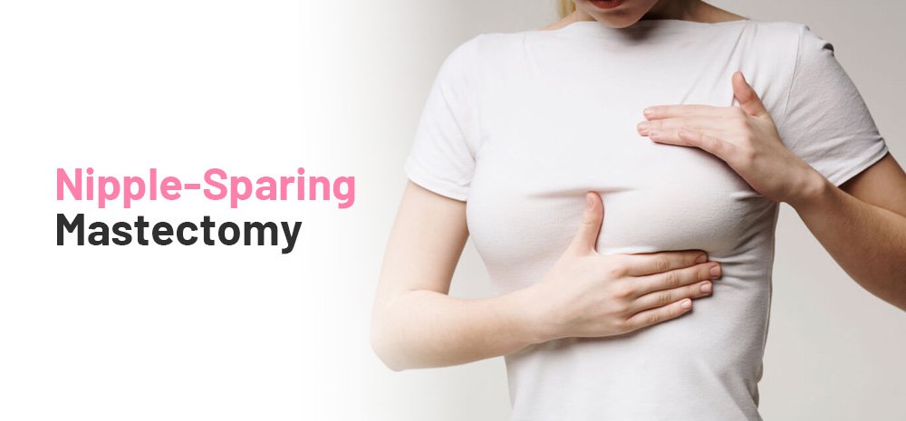 Nipple-Sparing Mastectomy